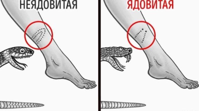 Что делать при укусе ядовитой змеи первая помощь